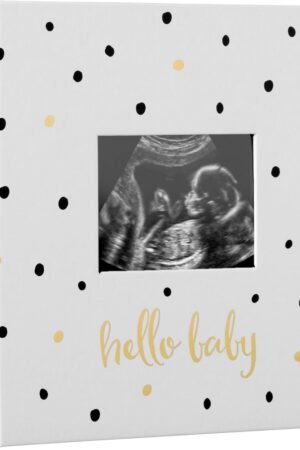 Photo Album, Keepsake Book for New and Expecting Parents, Gender-Neutral Baby Accessory, Ideal Gift for Baby Shower, Holds 200 Pictures, Black and Gold Polka Dot